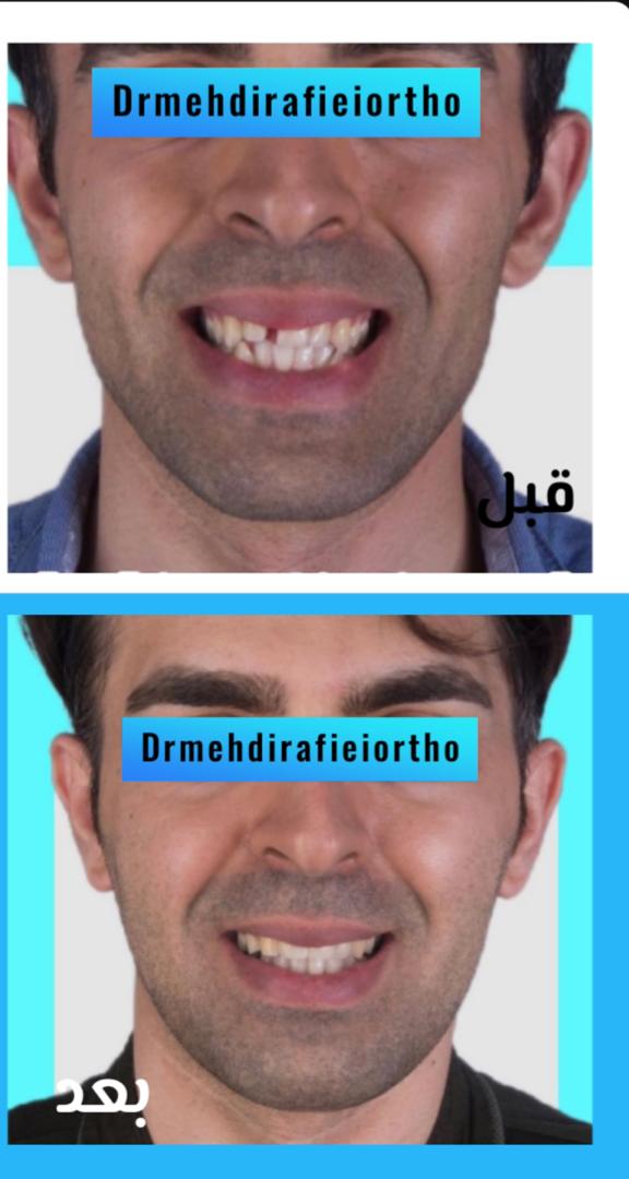 نمونه کار های ارتودنسی دکتر مهدی رفیعی
