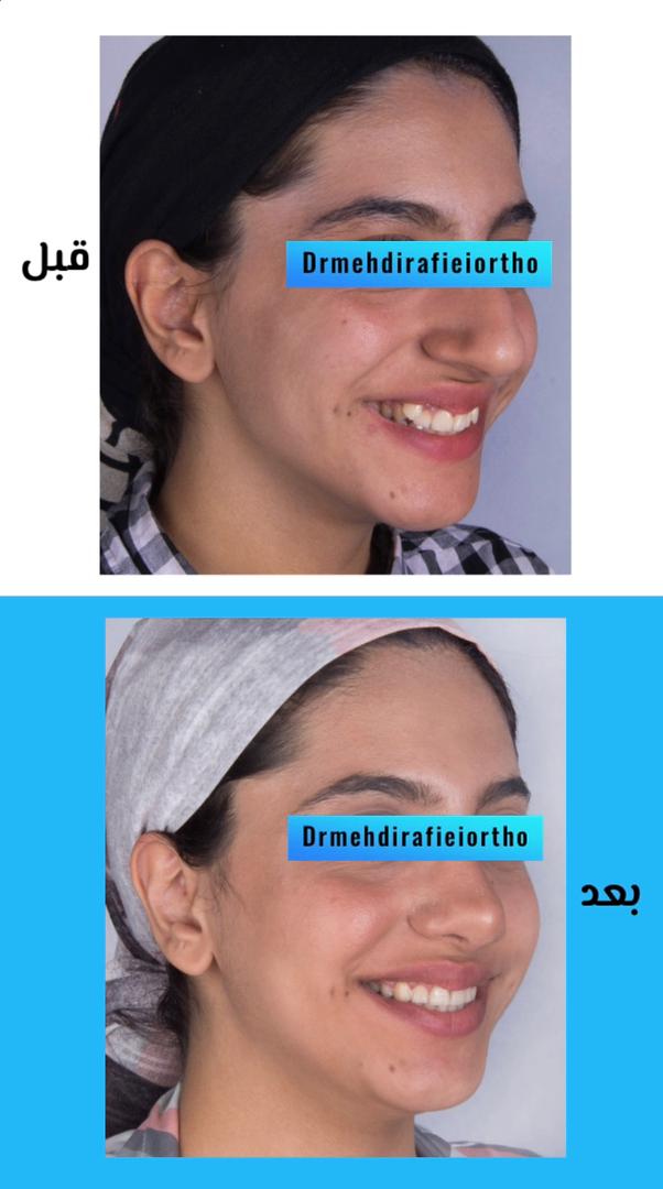نمونه کار های ارتودنسی دکتر مهدی رفیعی
