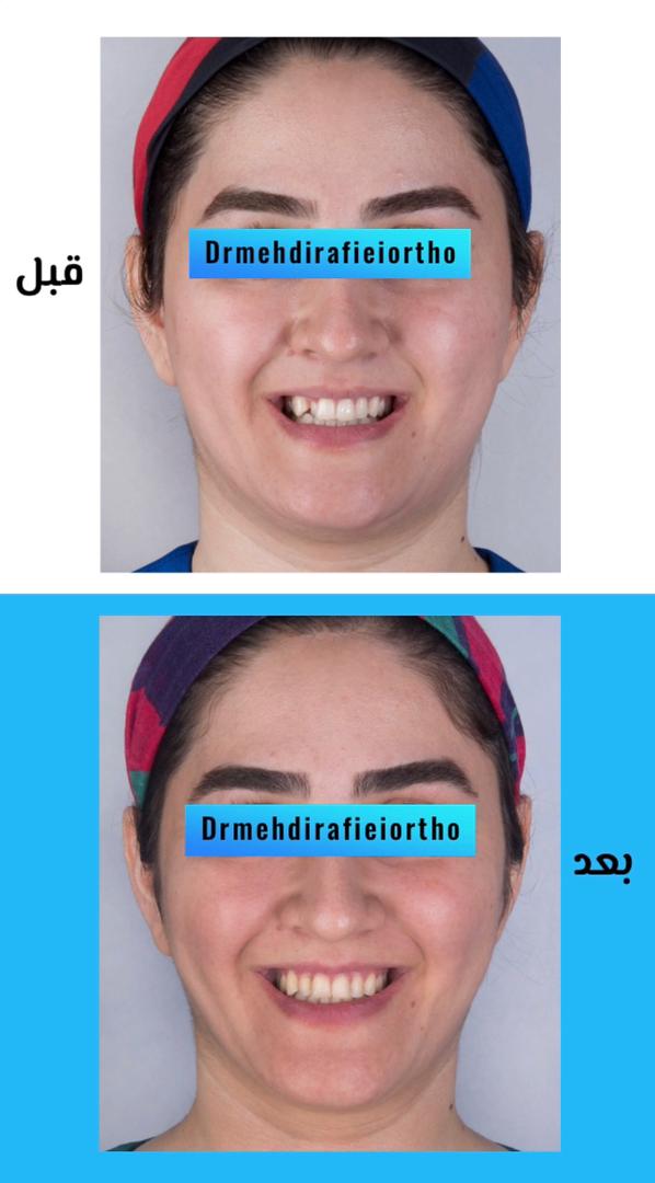نمونه کار های ارتودنسی دکتر مهدی رفیعی