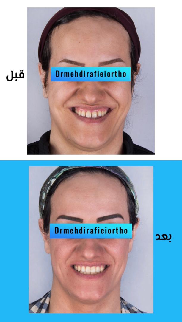 متخصص ارتودنسی اصفهان | دکتر مهدی رفیعی