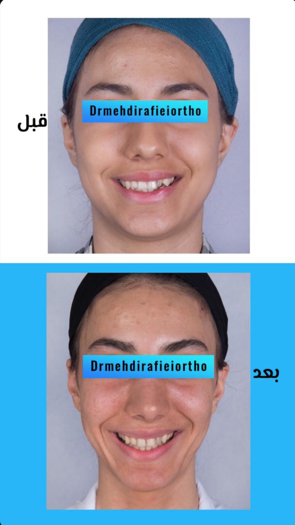 نمونه کار های ارتودنسی دکتر مهدی رفیعی