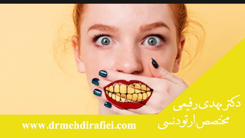علل اصلی زرد شدن دندان ها