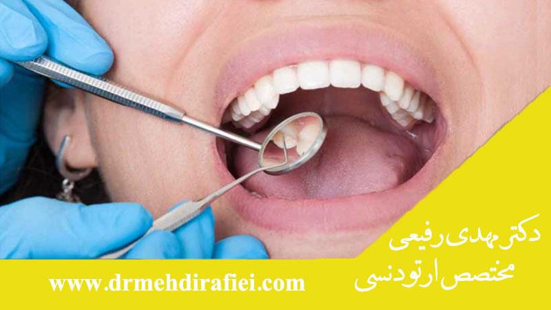 کشیدن دندان عقل بدون جراحی