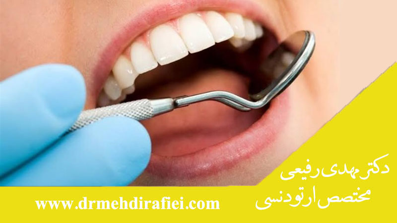 کامپوزیت یا لمینت یا روکش