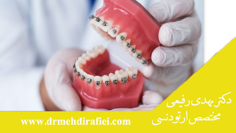 انواع روش‌های ارتودنسی