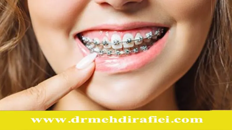 ارتودنسی و تصویر ذهنی از زیبایی