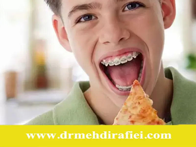 بهترین رژیم غذایی برای بیماران ارتودنسی