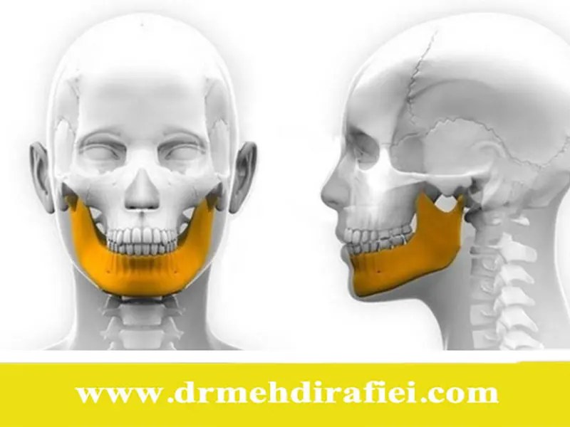 ارتودنسی و تاثیر آن بر مشکلات مفصل فکی گیجگاهی