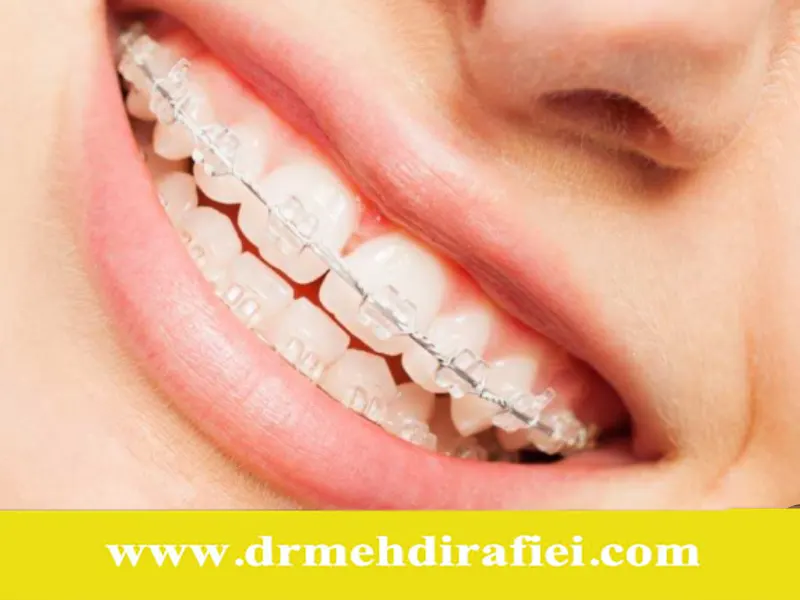 نقش پرینترهای سه‌بعدی در ساخت ارتودنسی