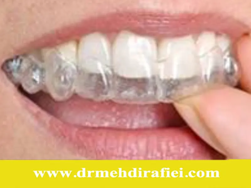 چگونه ارتودنسی می‌تواند مشکلات تنفسی را حل کند؟