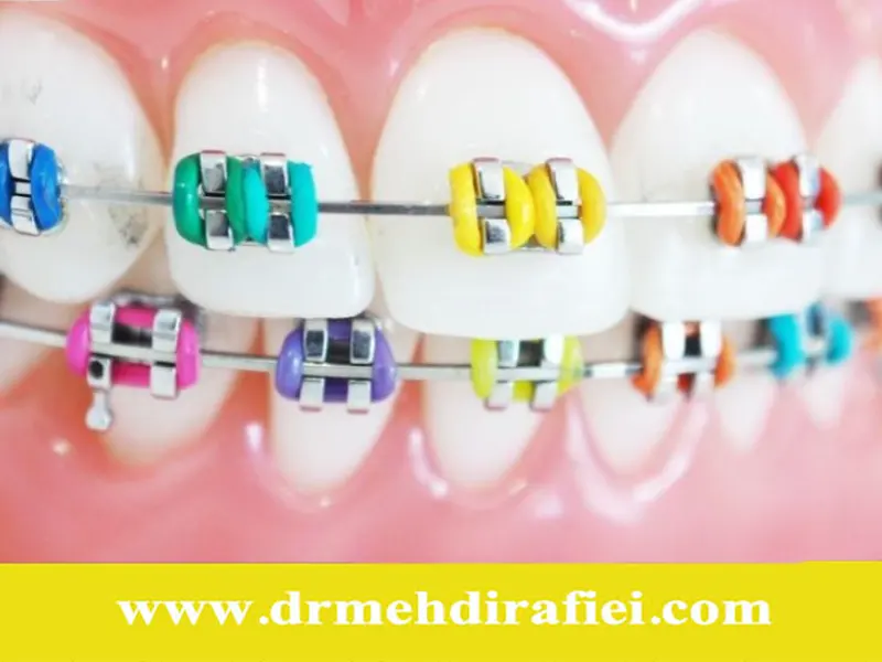 بررسی علمی موفقیت درمان ارتودنسی