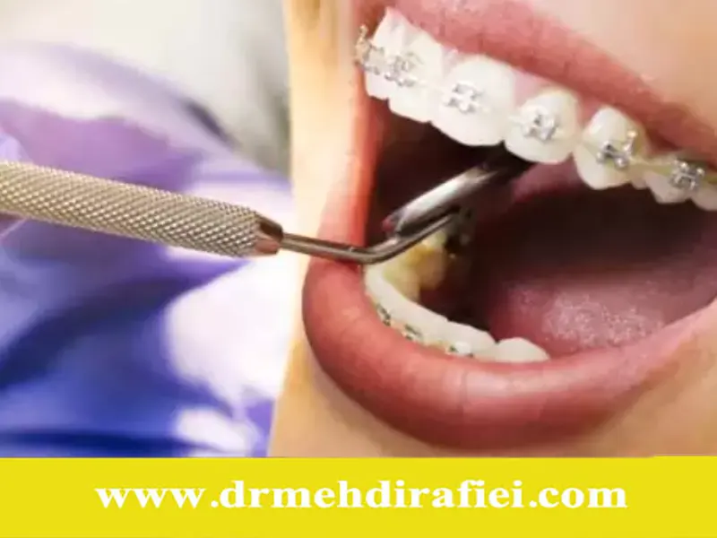 تأثیر ناهنجاری‌های دندانی و فکی بر سلامت دهان و کیفیت زندگی
