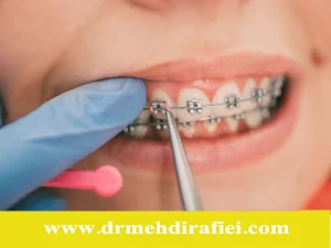 ارتودنسی برای بیماران خاص