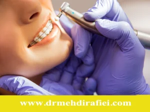 ارتودنسی برای بیماران خاص