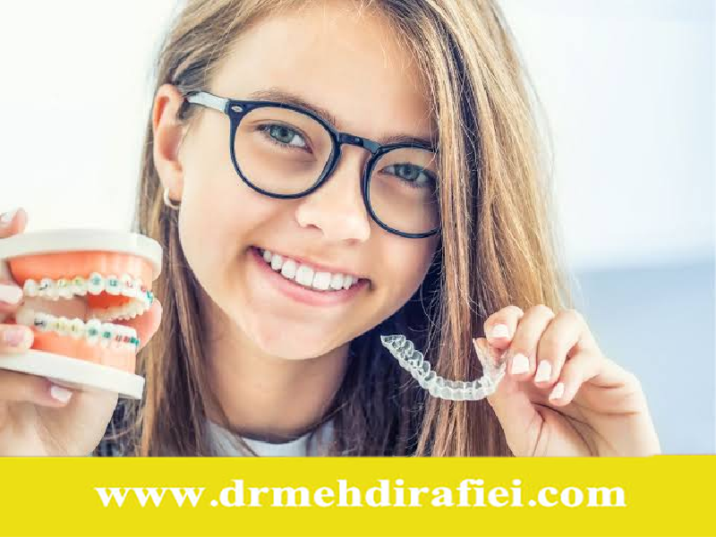 انواع ارتودنسی برای کودکان