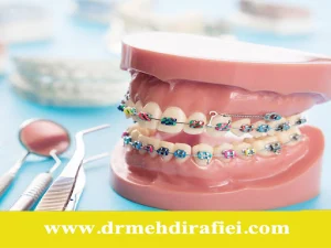 پیشگیری از آسیب ارتودنسی