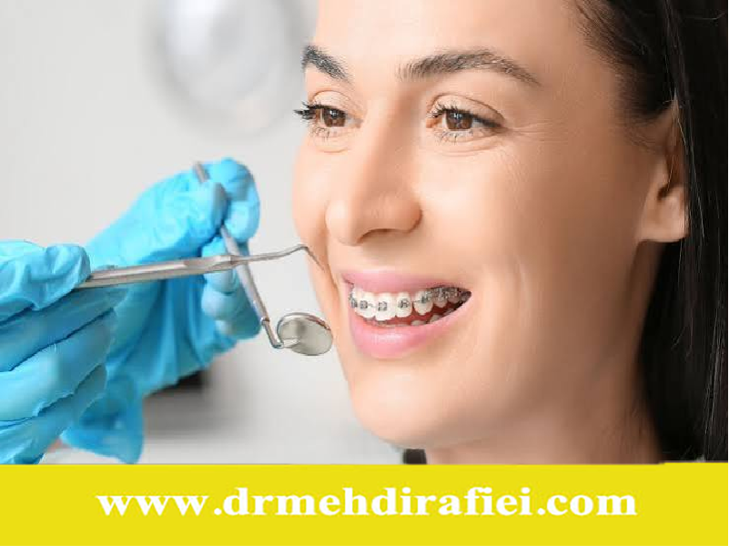پیشگیری از آسیب ارتودنسی