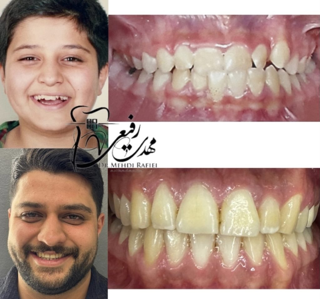 نمونه کار متخصص ارتودنسی اصفهان دکتر مهدی رفیعی