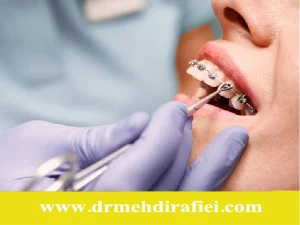 ارتودنسی برای بیماران خاص