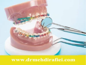 مراحل ارتودنسی