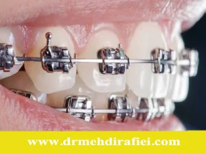 درمانهای پیشرفته ارتودنسی