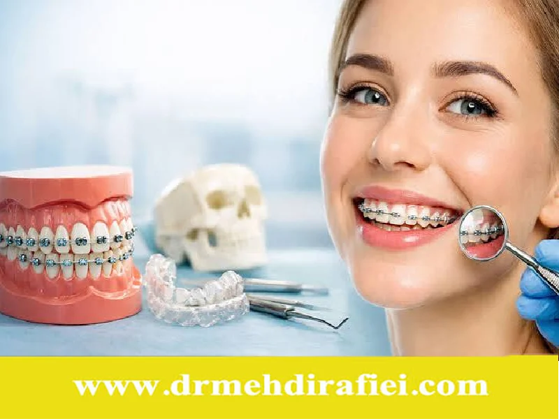 ارتودنسی و رژیم غذایی آن