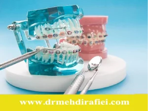 ارتودنسی و رژیم غذایی آن
